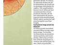 kleszcze czyhają na drzewach i w trawie 2
