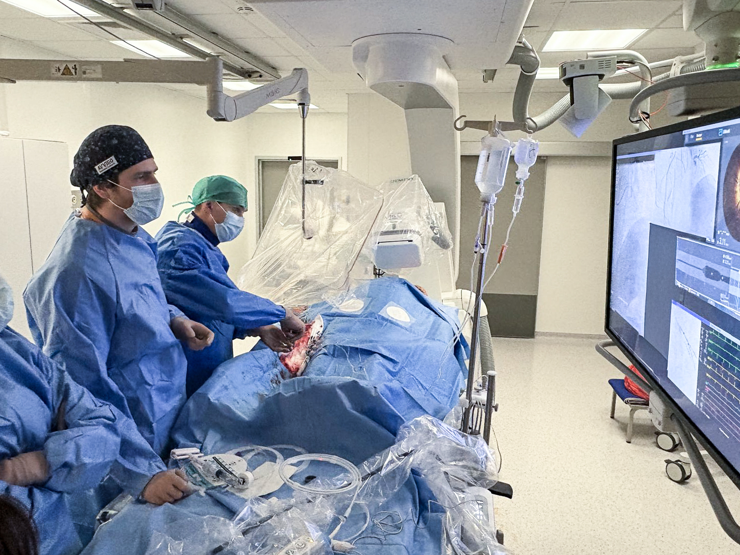 operacja założenia stentów