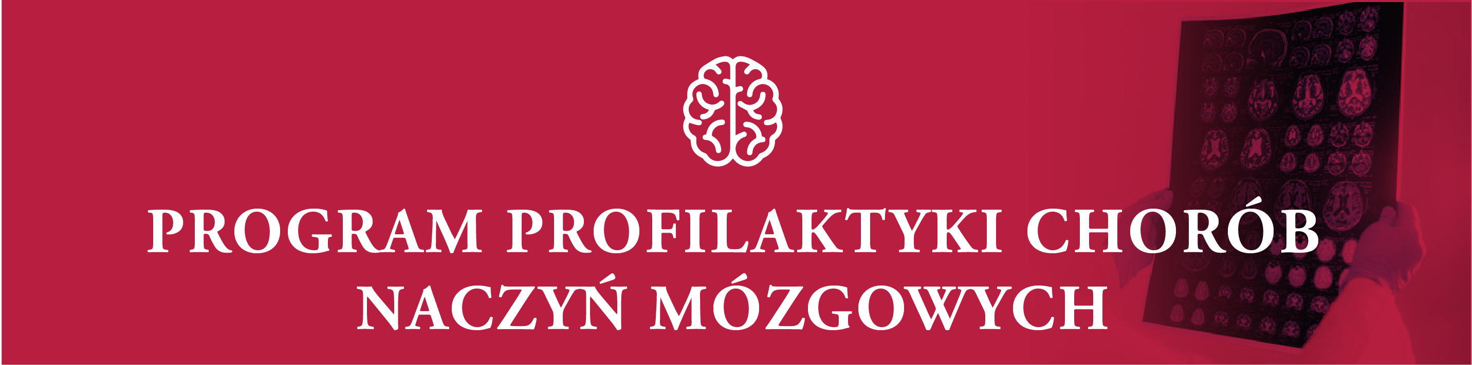 kafelek: program profilaktyki chorób naczyń mózgowych