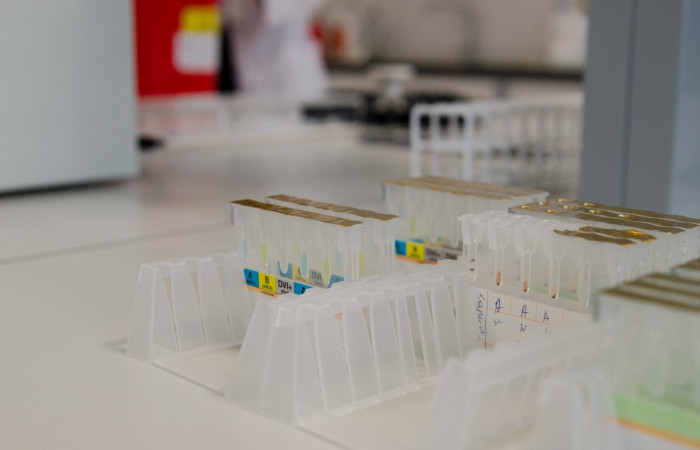 Sprzęt Zakładu Diagnostyki - zbliżenie na detale