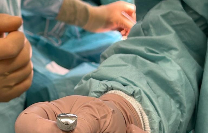 Zdjęcie z zabiegu artroplastyki