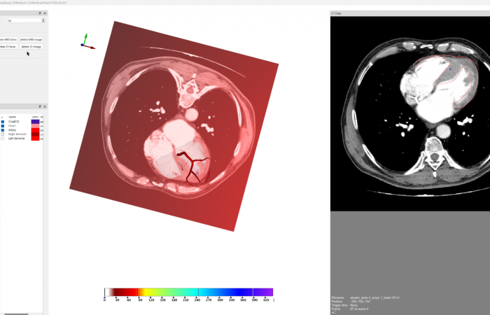 Pracownia Funkcjonalnego i Wirtualnego Medycznego Obrazowania 3D