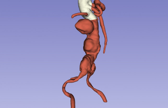 Pracownia Funkcjonalnego i Wirtualnego Medycznego Obrazowania 3D