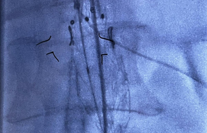 e955eb2d-2a7b-4a72-bb7e-2f778c07f81f