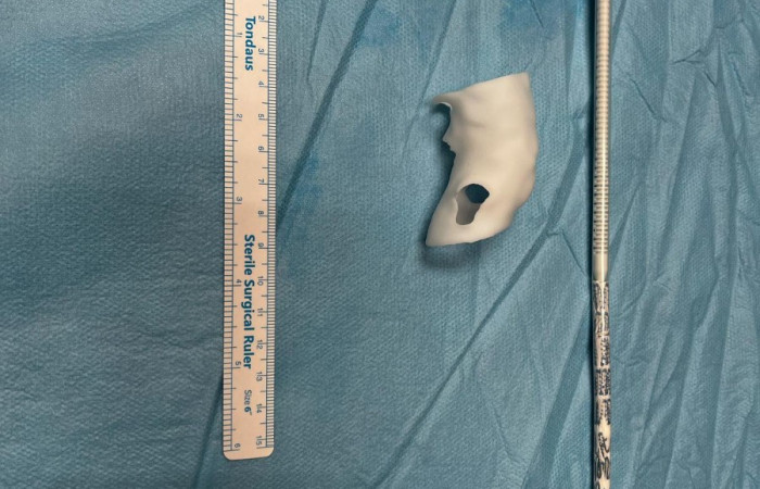 ee4c3b20-5580-47ac-8d80-411a41772112